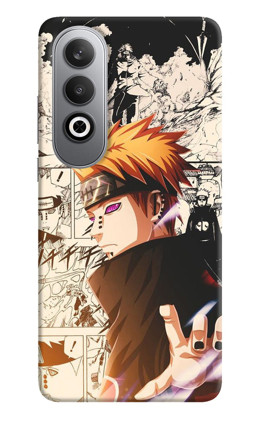 Pain Anime Case for Oneplus Nord CE4