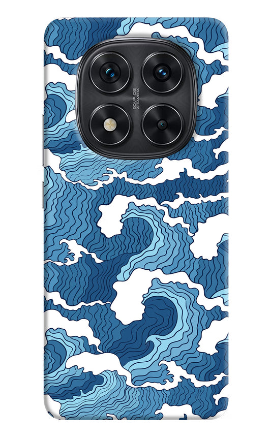 Blue Waves Case for Redmi Note 14 Pro 5G by Casekaro