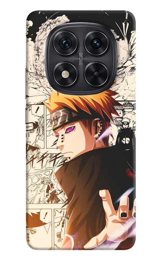 Pain Anime Case for Redmi Note 14 Pro 5G by Casekaro